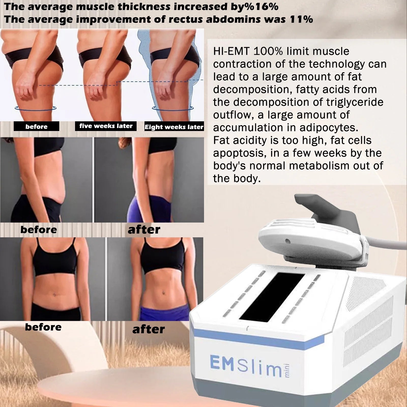 Muscle Stimulator for Body Toning and Skin Tightening S26540