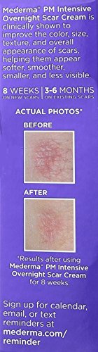 Overnight Scar Cream for Smaller, Less Visible Scars, 1 oz L874888